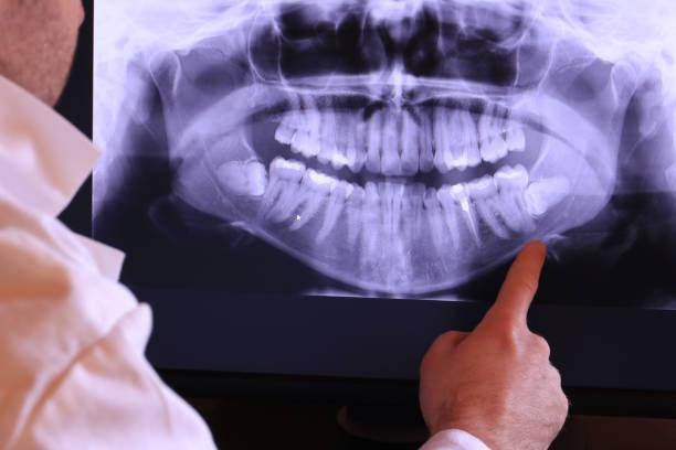 Best Chipped Tooth Repair Near Me  in Spirit Lake, ID